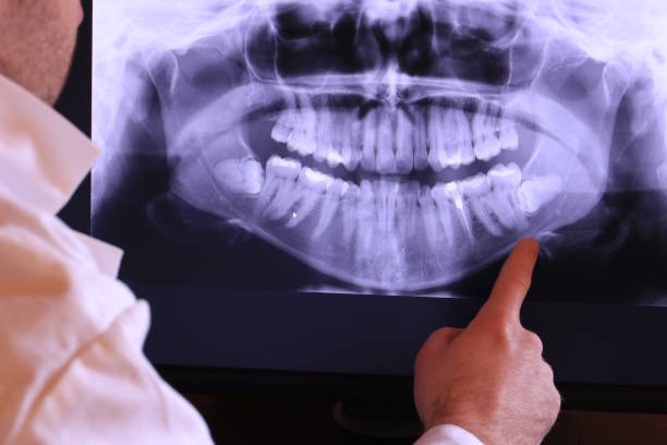 Best Emergency Wisdom Teeth Removal in Webster, TX